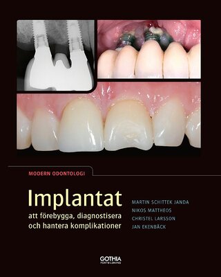 Implantat