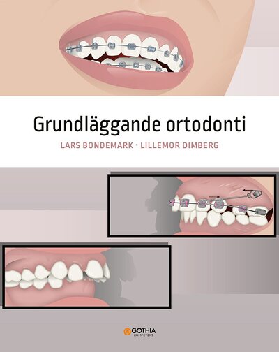 Grundläggande ortodonti