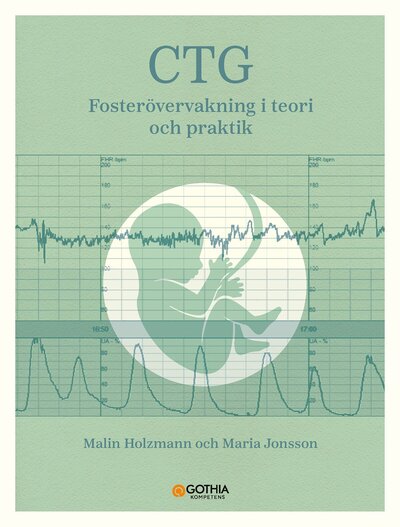 CTG – fosterövervakning i teori och praktik
