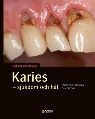 Karies